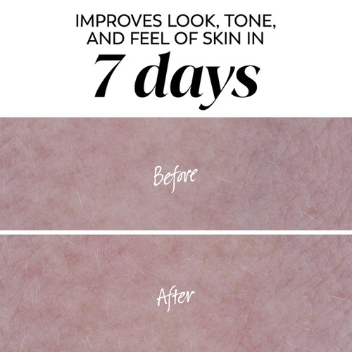 Before and after images of skin. Improves look, tone and feel of skin in 7 days.