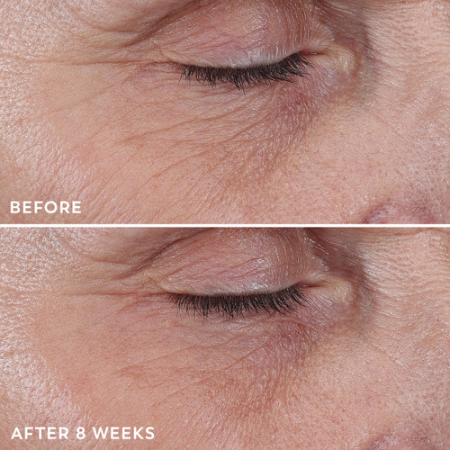 Model posing with before and after using Regenerist Eye Wrinkle Correcting Treatment on eyes for 8 weeks