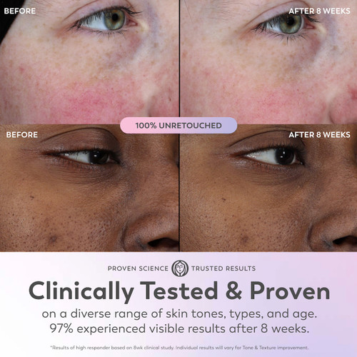 4 before and after images before using Super Serum and after 8 weeks. Clinically tested and proven on a diverse range of skin tones, types and age. 97% experienced visible results after 8 weeks. *results of high responder based on 8wk clinical study. Individual results will vary for tone and texture improvement.