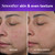 Model showing before and after using Retinol Face Moisturizer. Smoother skin and even skin texture