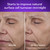 Model showing before and after using Retinol Max Face Moisturizer. Starts to improve natural surface cell turnover overnight