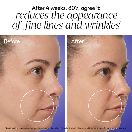 Model before and after applying Olay Retinol 24 MAX Night Moisturizer cream. After 4 weeks, 80% agree it reduces the appearance of fine lines and wrinkles.* *results of an average responder based on 8wk study. Individual results will vary for tone and texture improvement